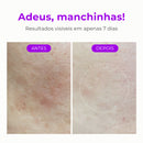 ClareaShot - Sérum de Vitamina C Que Clareia Manchas e Áreas Escuras