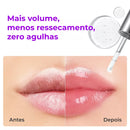 SpiculeShot – Lip Plumper Com Tecnologia Coreana Que Aumenta o Volume (Oferta Exclusiva)